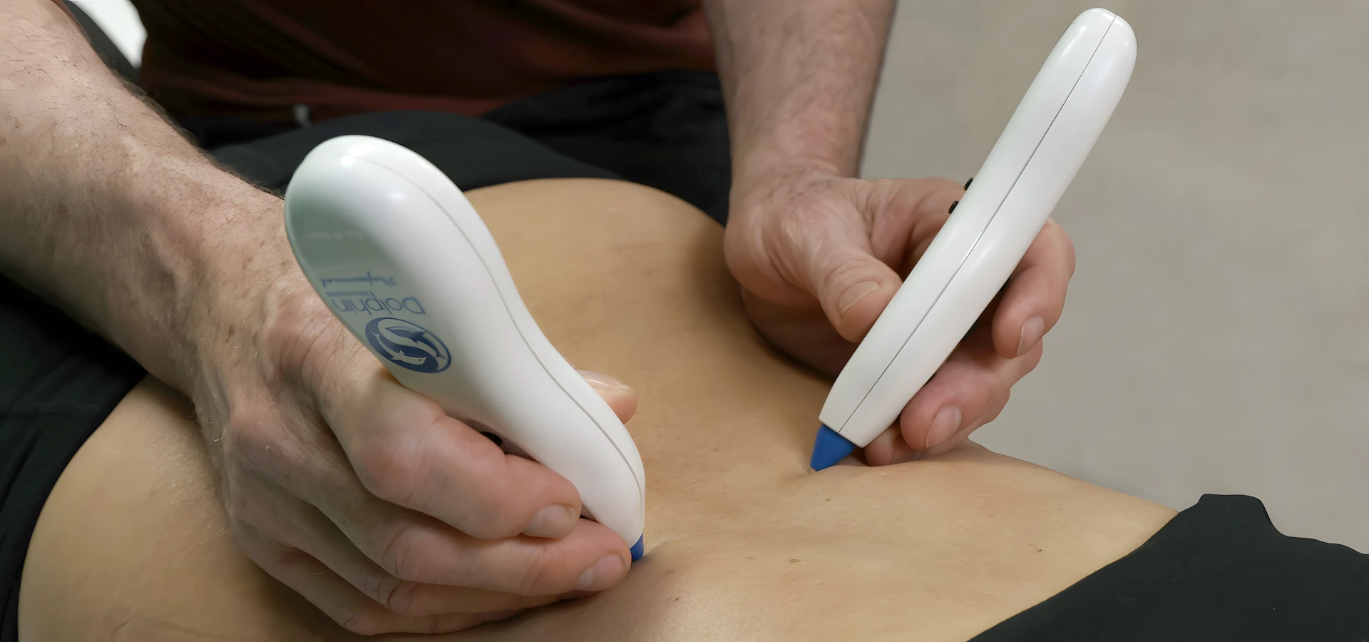 Kỹ thuật điều trị bằng hai thiết bị Dolphin MPS tại vùng lưng